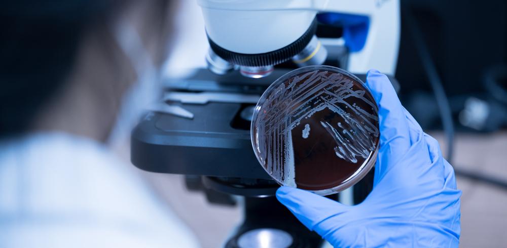 Controllo di Bacillus cereus nelle filiere alimentari Petrifilm™ Neogen a confronto con ISO 7932